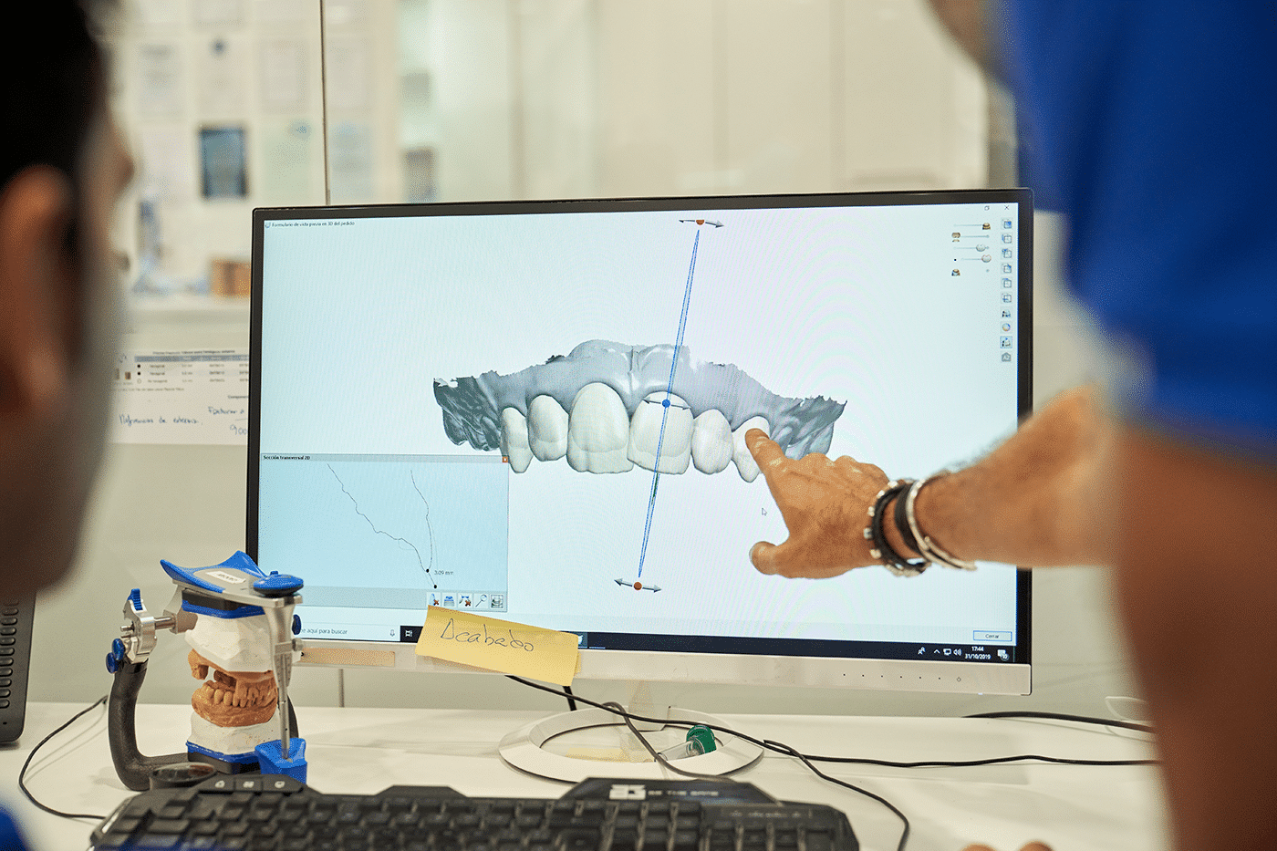 A close-up of a 3D scanner capturing detailed images of teeth for dental analysis and treatment planning