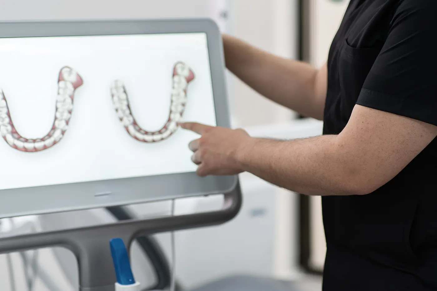 adult braces