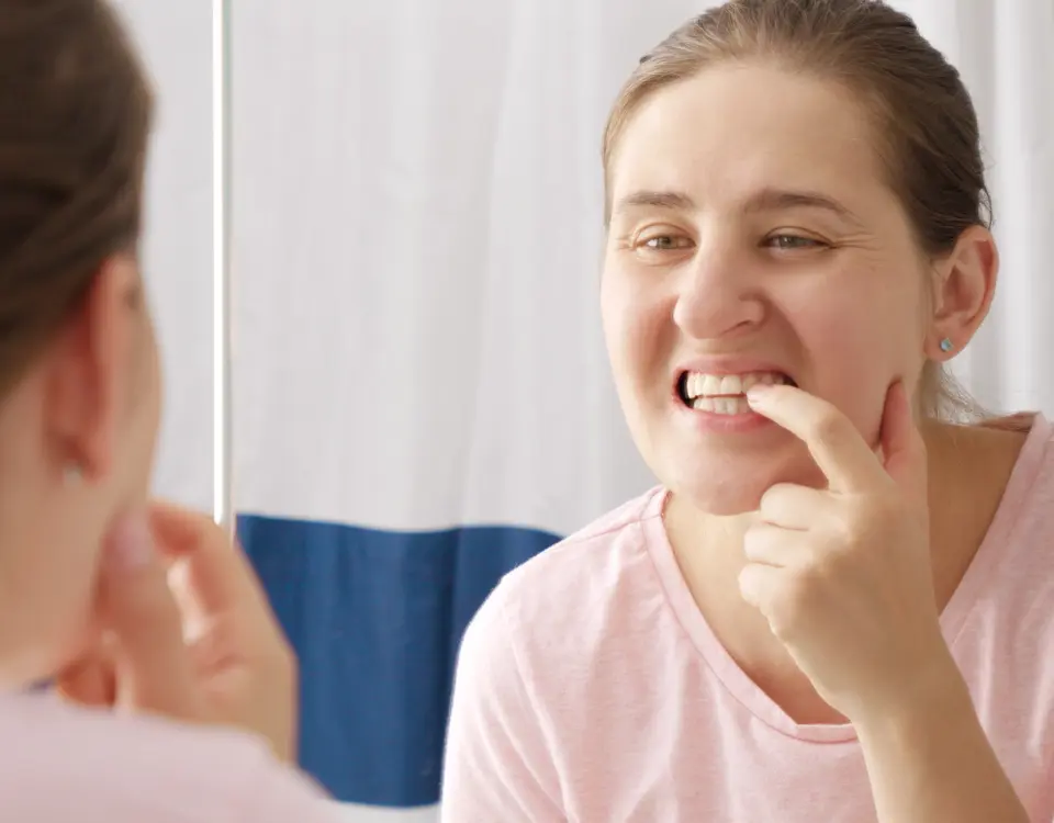 chipped tooth repair